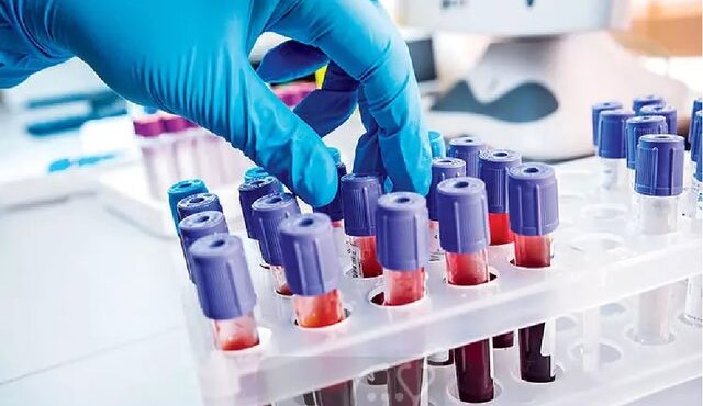 مشکل کشور در حوزه پالایش پلاسما تا ۳ سال آینده مرتفع می‌شود