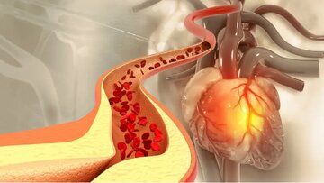 آیا باید از کلسترول و تری‌گلیسیرید بالا ترسید؟